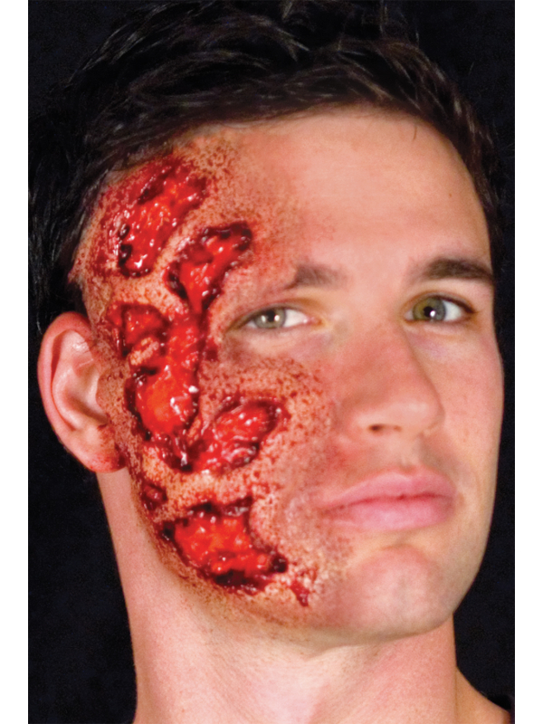 Blessure de Brûlure en Latex Woochie - Maquillage FX pour Halloween Réaliste
