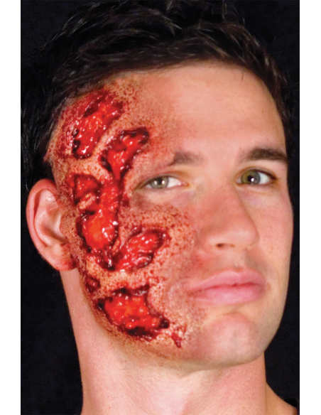 Blessure de Brûlure en Latex Woochie - Maquillage FX pour Halloween Réaliste
