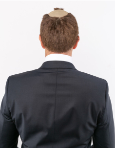 Perruque Chauve avec Toupet Brun – Déguisement Moine ou Professeur 2